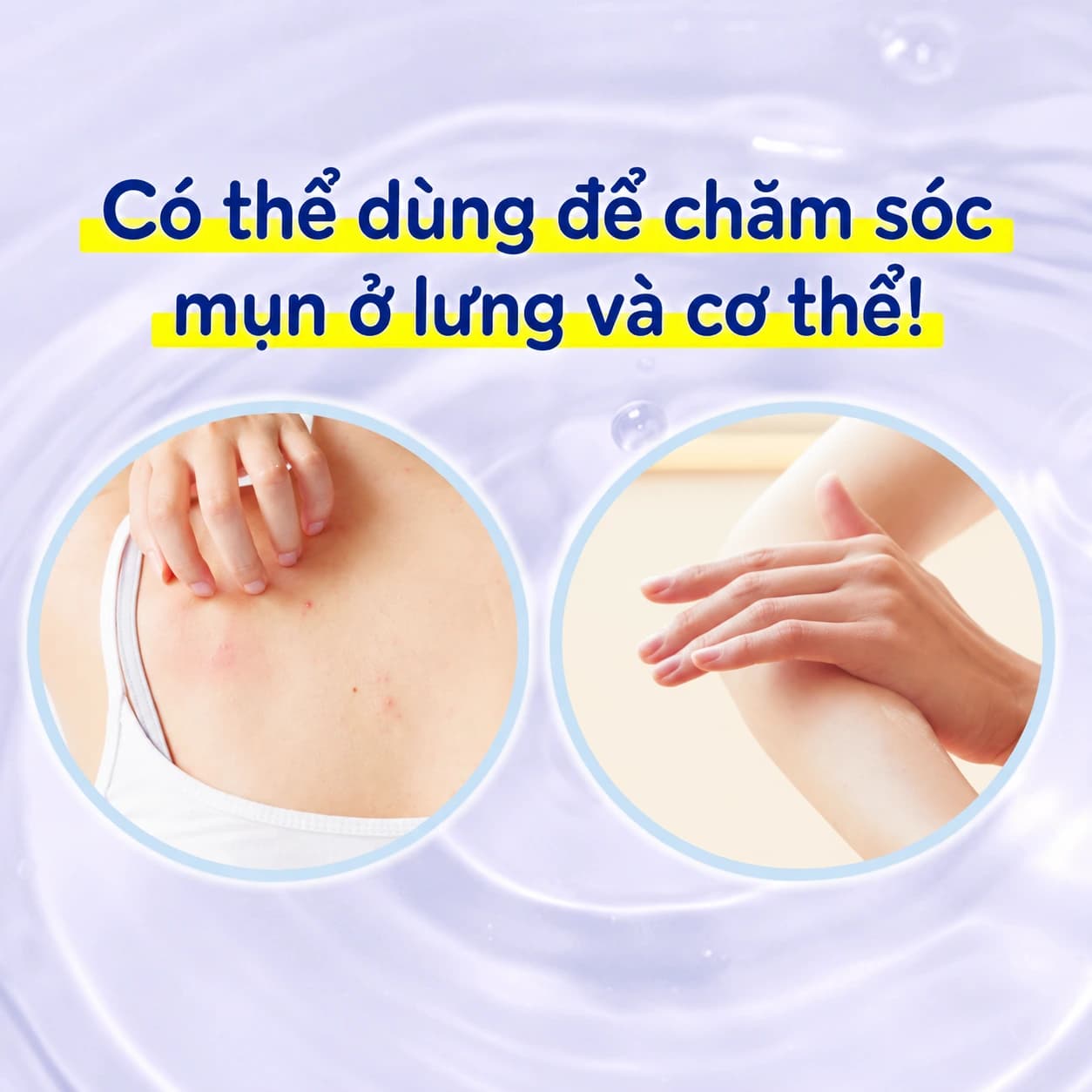 Xà phòng làm sạch, hỗ trợ ngăn ngừa mụn mặt, lưng và ngực Meishoku Bigan Medicated Soap 80g — ảnh 3