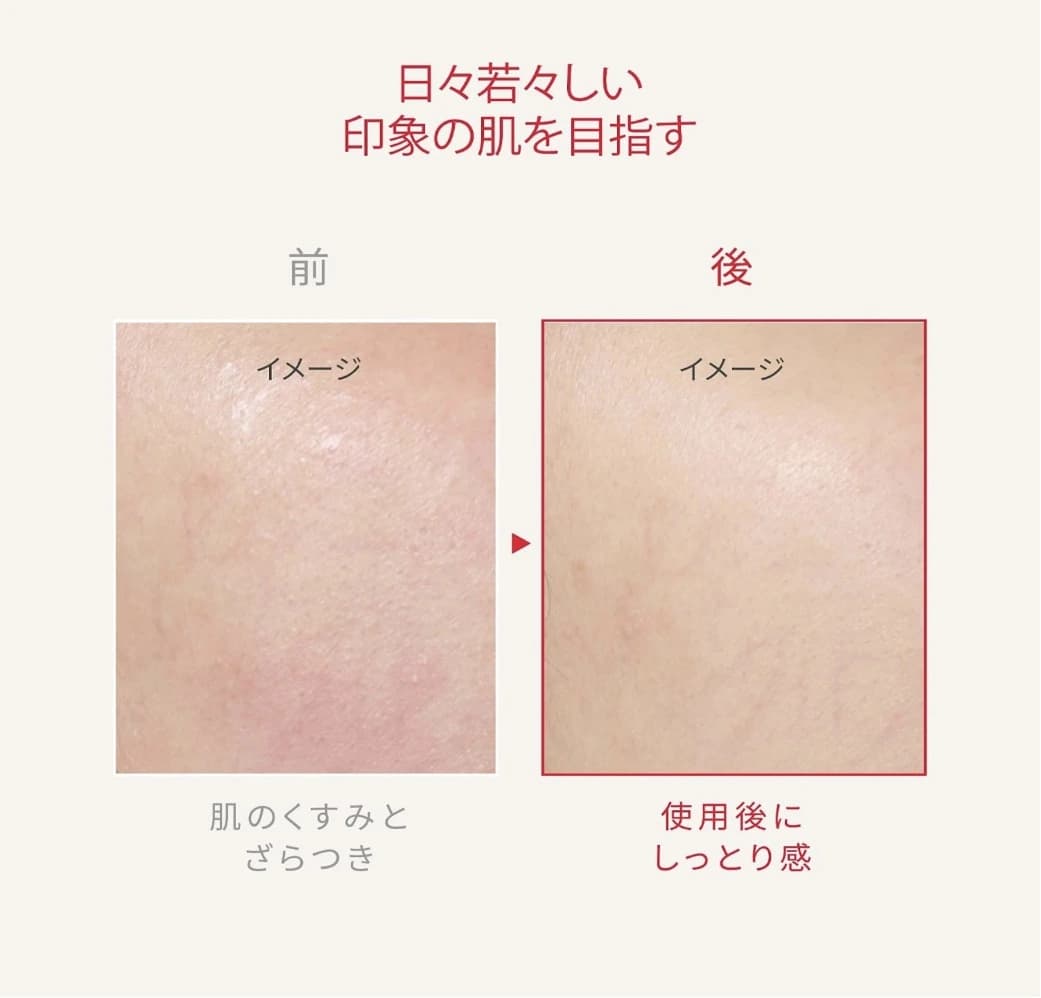 Bộ dưỡng da SHISEIDO Ultimune Trial Kit — ảnh 2